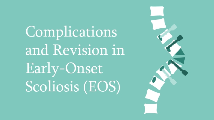 Early-Onset Scoliosis Complications & Revisions surgery lecture thumbnail