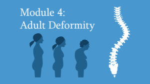 Module 4: Adult Deformity of the Spine