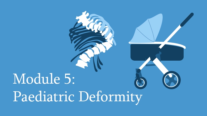 Module 5: Paediatric Deformity