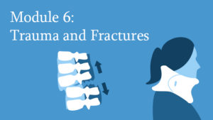Module 6: Spine Trauma and Fractures