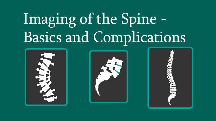 Spine Radiology: Imaging in the Spine Basics & Complications Knowledge Package