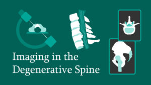 Imaging in the Degenerative Spine