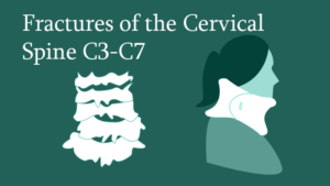 Fractures of the Cervical Spine C3-C7