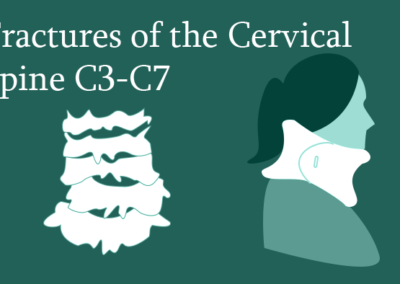 Fractures of the Cervical Spine C3-C7