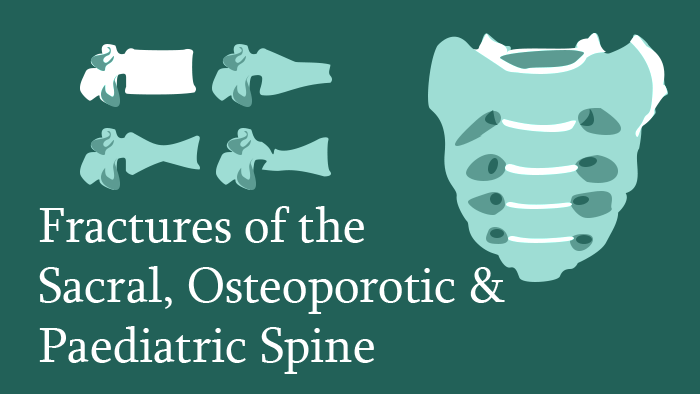 Sacral, Osteoporotic and Paediatric Spine Trauma