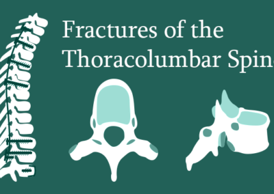 Fractures of the Thoraco-lumbar Spine