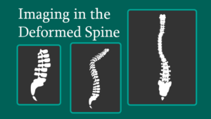 Imaging in the Deformed Spine