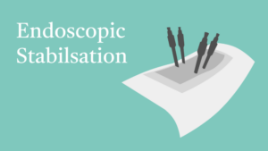10.12 Endoscopic Stabilization