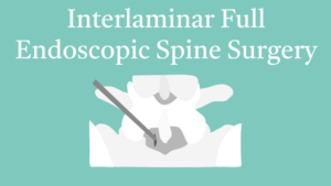 10.13 Interlaminar Full Endoscopic Spine Surgery