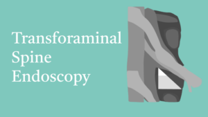 10.3 Transforaminal Spine Endoscopy