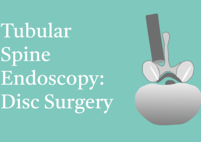 10.5 Tubular Spine Endoscopy: Disc surgery