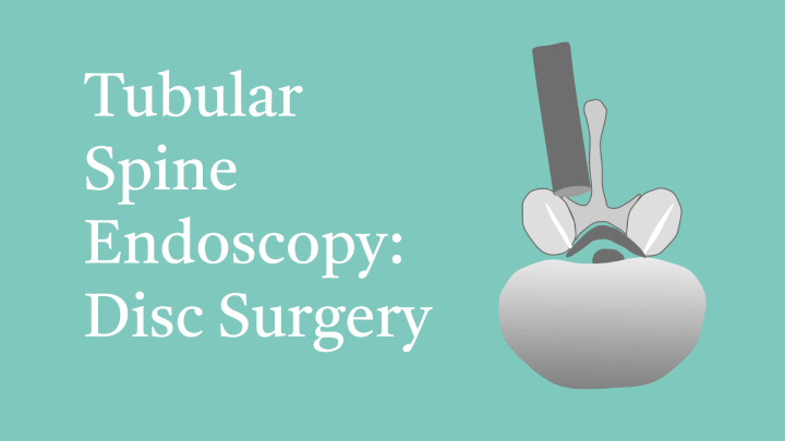 Tubular Spine Endoscopy: Disc Surgery Lecture