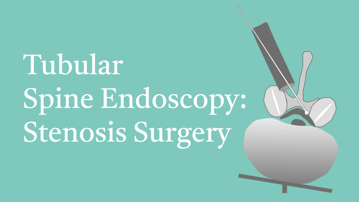 Tubular Spine Endoscopy: Stenosis Surgery Lecture