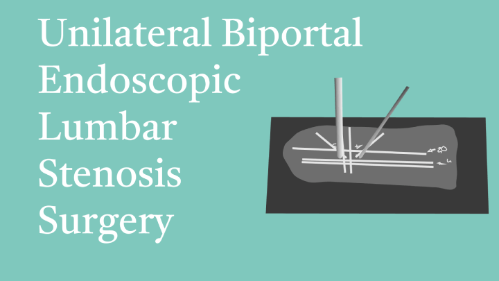 Uniportal Bilateral Endoscopy Lumbar Stenosis Surgery Lecture